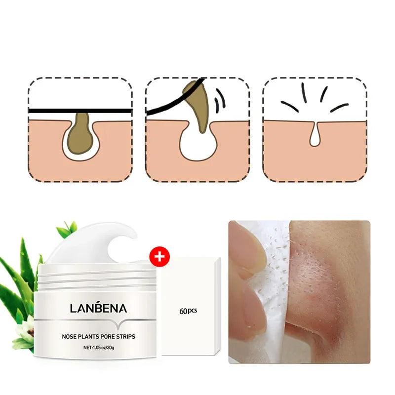 LANBÉNA Máscara de Aloe Vera para Cravos